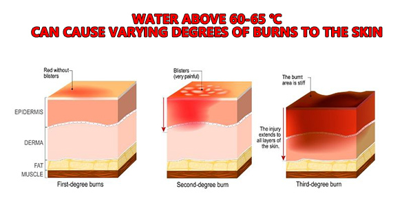 水温超过 60-65 ℃ 会对皮肤造成不同程度的灼伤